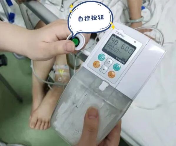 pca泵是什么带您了解自控镇痛泵（PCA）_https://www.jmylbn.com_新闻资讯_第2张