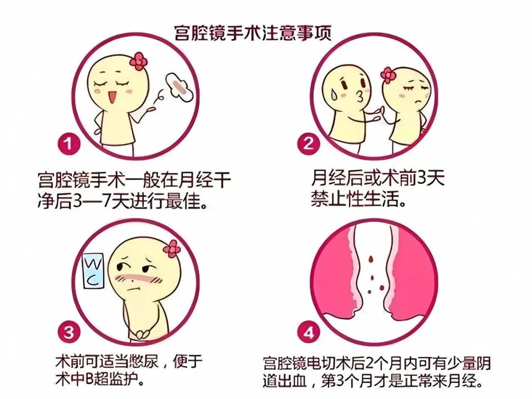 宫颈活检器械长什么样小宫腔，大世界丨带你认识宫腔疾病检查神器“ 宫腔镜 ”_https://www.jmylbn.com_新闻资讯_第8张