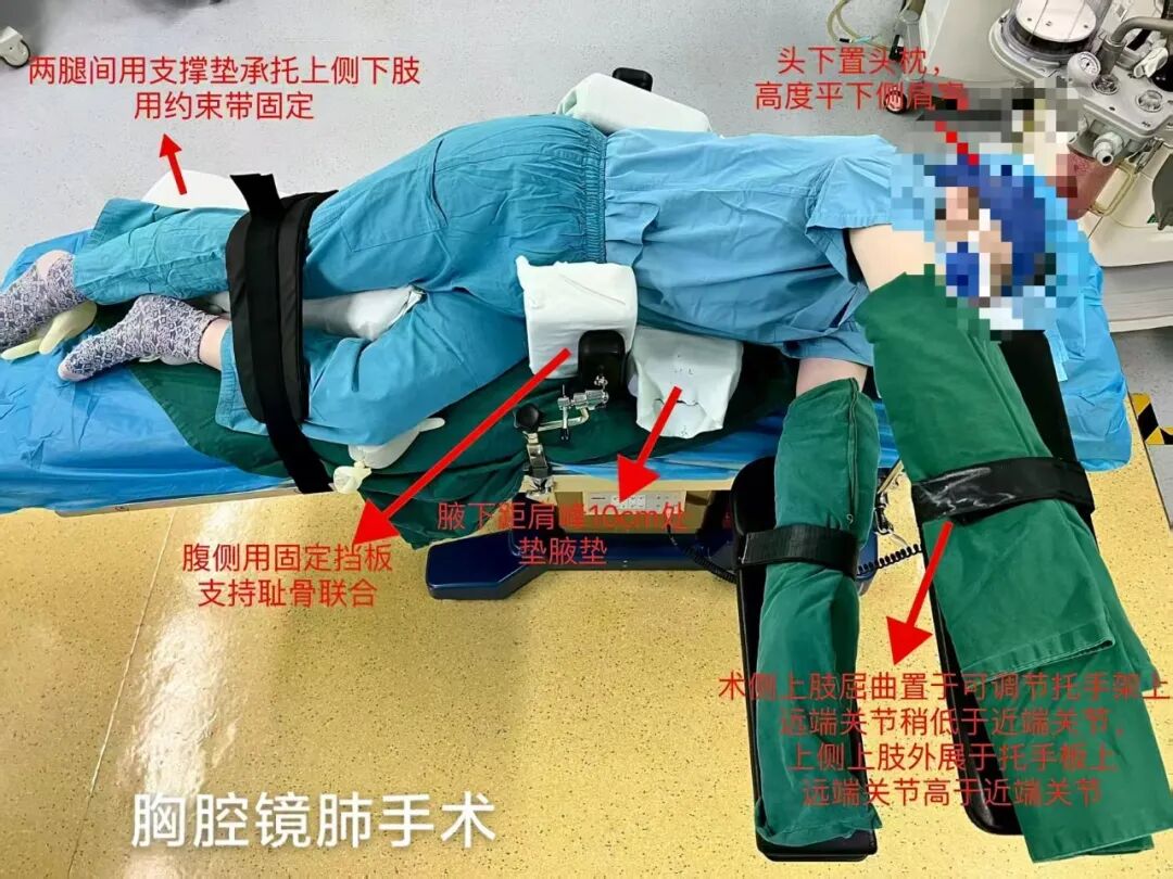 手术室体位垫怎么用【改善护理服务】以垫为基 护航术程——手术室体位垫优质护理实践与探索_https://www.jmylbn.com_新闻资讯_第9张