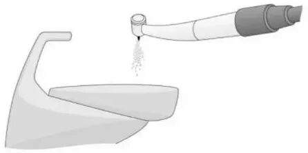 牙科手机怎么消毒口腔诊疗器械的消毒灭菌操作-牙科手机篇（含示意图）_https://www.jmylbn.com_新闻资讯_第1张