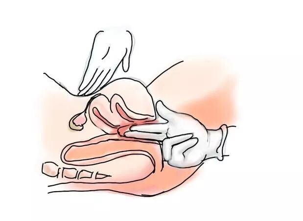 妇科检查床怎么组合妇科检查操作流程及视频_https://www.jmylbn.com_新闻资讯_第19张