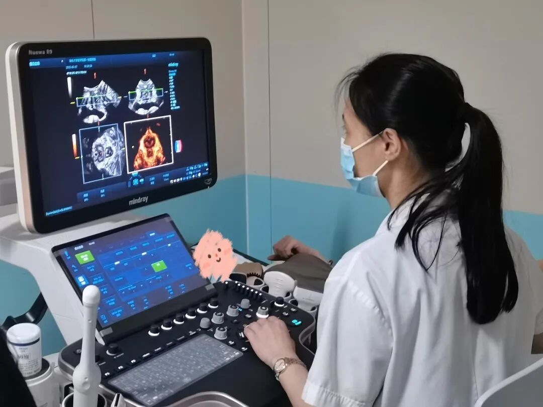 什么是超声容积探头医疗人工智能开启女性智能盆底超声检查新纪元_https://www.jmylbn.com_新闻资讯_第4张