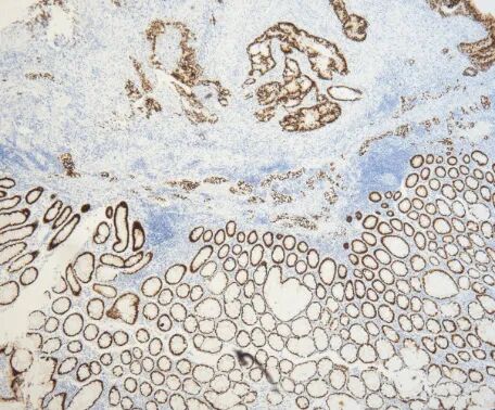 组织块大怎么包埋仅需12步，助你做出完美免疫组化IHC片子_https://www.jmylbn.com_新闻资讯_第14张