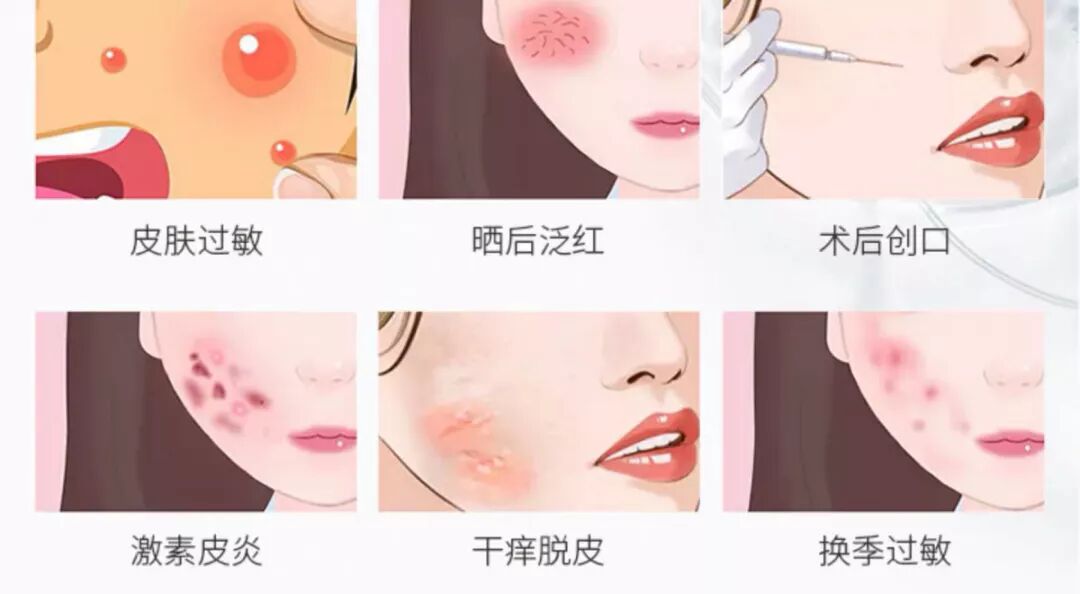 可吸收医用膜是什么医用面膜是坑吗？它和普通面膜有什么区别？_https://www.jmylbn.com_新闻资讯_第2张