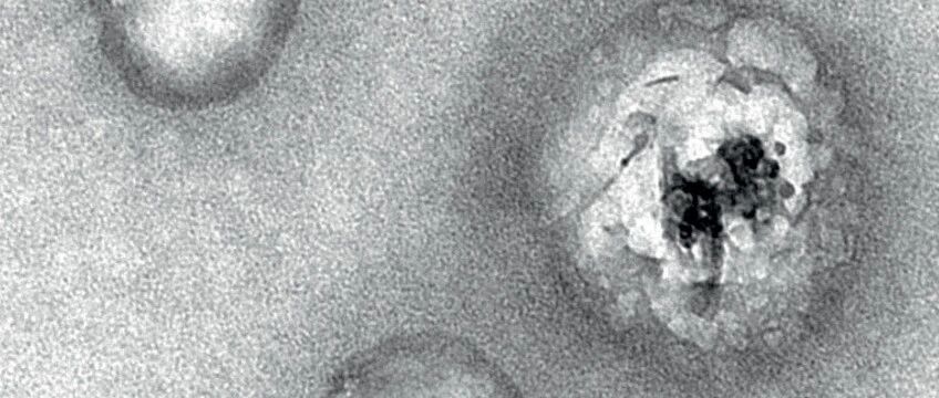 长文解析最新诺奖研究：一年杀死40万人的致命传染性，即将迎来末日？