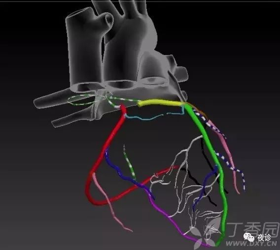 图解心电图！定位心梗犯罪血管