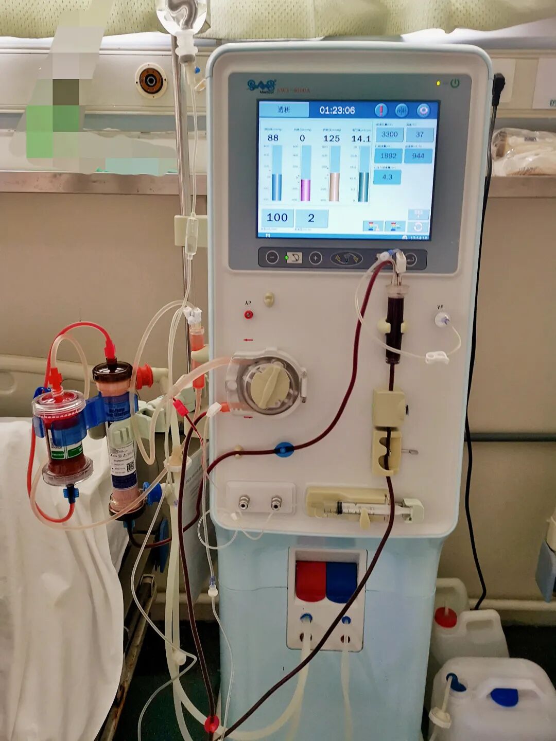 医用吊桥是什么医院这些“神器”，究竟多厉害？_https://www.jmylbn.com_新闻资讯_第18张