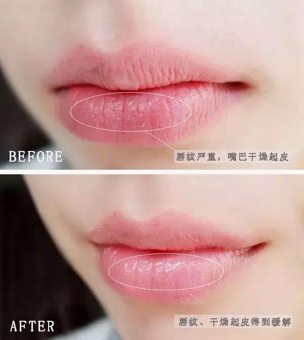 急救沙漠唇 嘴唇干裂 起皮 每晚一涂 嫩出水 胜过10次唇部滋润 学多点健康常识 微信公众号文章阅读 Wemp