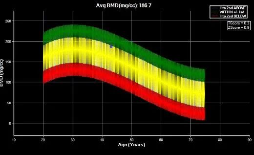 飞利浦都有哪些系列CT设备再升级 ｜ 飞利浦极速ICT，更大程度满足影像检查需求！_https://www.jmylbn.com_新闻资讯_第19张