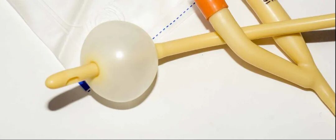 尿管怎么固定护士，导尿管二次固定位置你可能选错了！_https://www.jmylbn.com_新闻资讯_第2张