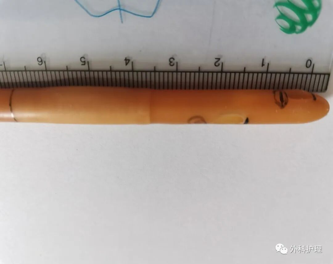 三腔导尿管怎么使用护士，下了尿管以后为啥我尿里有血，还总想尿尿啊？_https://www.jmylbn.com_新闻资讯_第7张