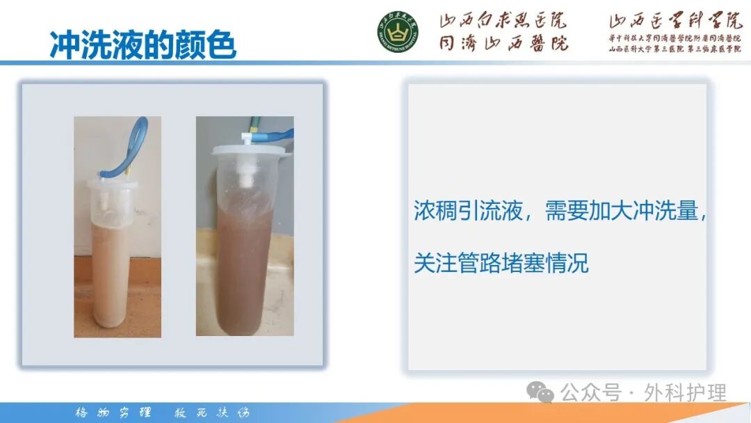 为什么负压引流【PPT】密闭式负压封闭引流技术相关知识_https://www.jmylbn.com_新闻资讯_第22张