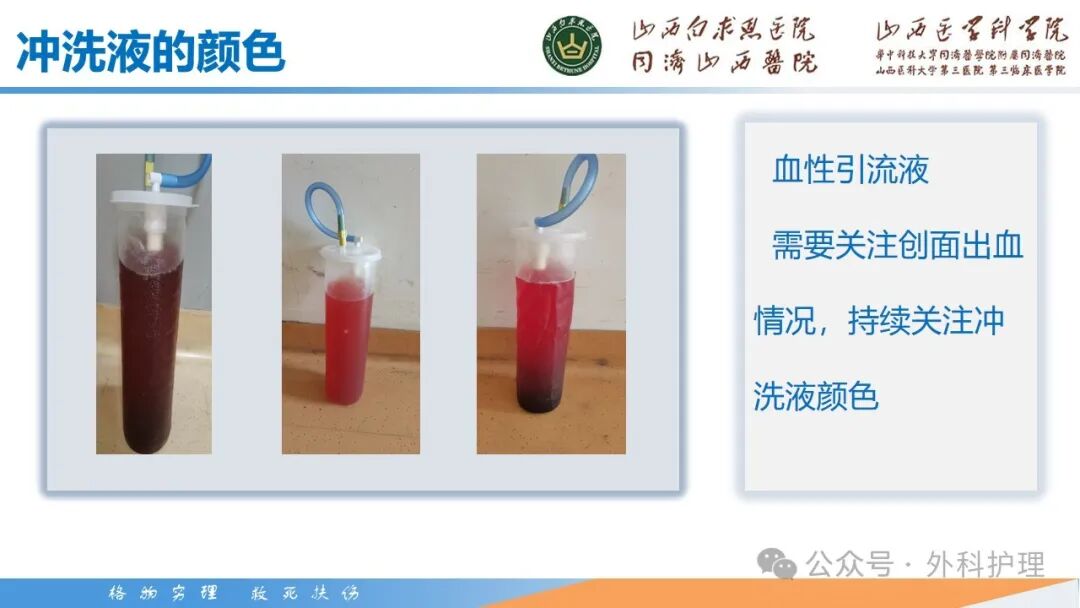 为什么负压引流【PPT】密闭式负压封闭引流技术相关知识_https://www.jmylbn.com_新闻资讯_第23张