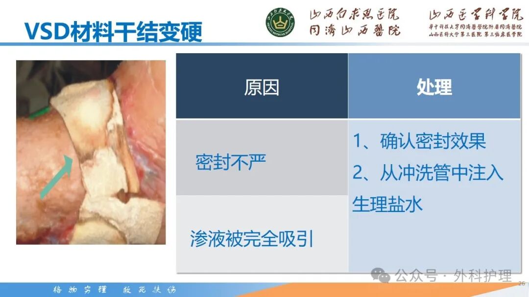 为什么负压引流【PPT】密闭式负压封闭引流技术相关知识_https://www.jmylbn.com_新闻资讯_第27张