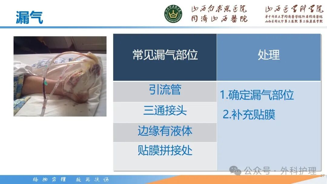 为什么负压引流【PPT】密闭式负压封闭引流技术相关知识_https://www.jmylbn.com_新闻资讯_第28张