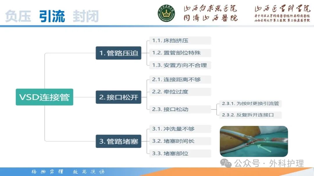 为什么负压引流【PPT】密闭式负压封闭引流技术相关知识_https://www.jmylbn.com_新闻资讯_第36张