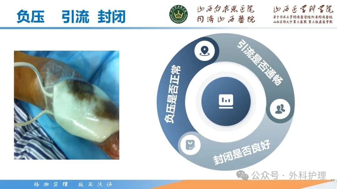 为什么负压引流【PPT】密闭式负压封闭引流技术相关知识_https://www.jmylbn.com_新闻资讯_第30张