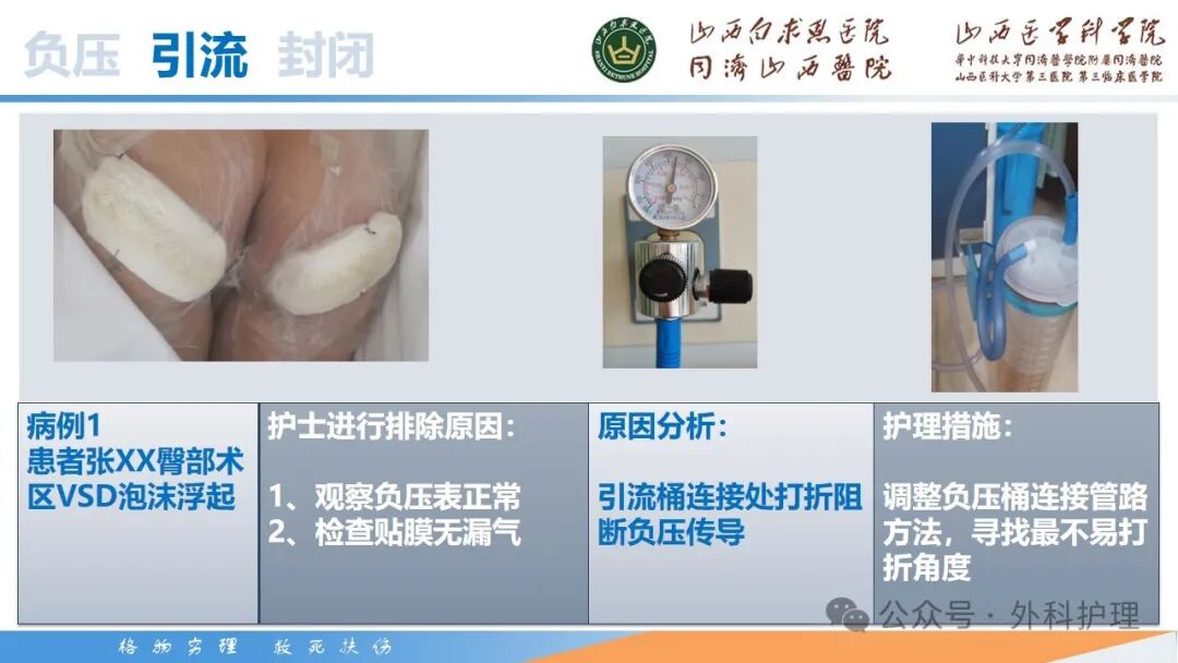 为什么负压引流【PPT】密闭式负压封闭引流技术相关知识_https://www.jmylbn.com_新闻资讯_第32张