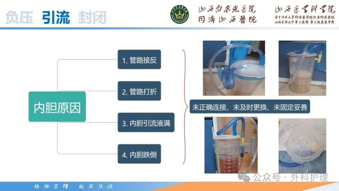 为什么负压引流【PPT】密闭式负压封闭引流技术相关知识_https://www.jmylbn.com_新闻资讯_第35张