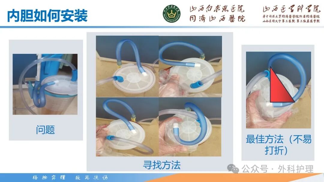 为什么负压引流【PPT】密闭式负压封闭引流技术相关知识_https://www.jmylbn.com_新闻资讯_第33张