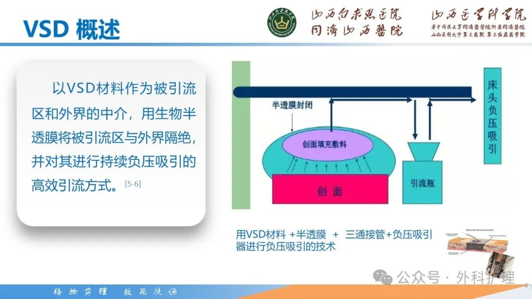 为什么负压引流【PPT】密闭式负压封闭引流技术相关知识_https://www.jmylbn.com_新闻资讯_第7张