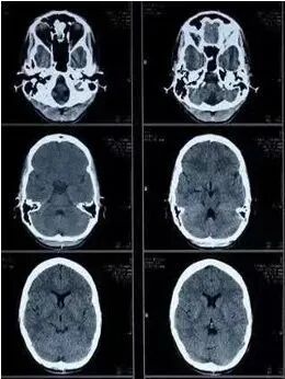 X光拍片为什么要等都是拍片，DR、CT、MRI，到底啥区别？_https://www.jmylbn.com_新闻资讯_第8张
