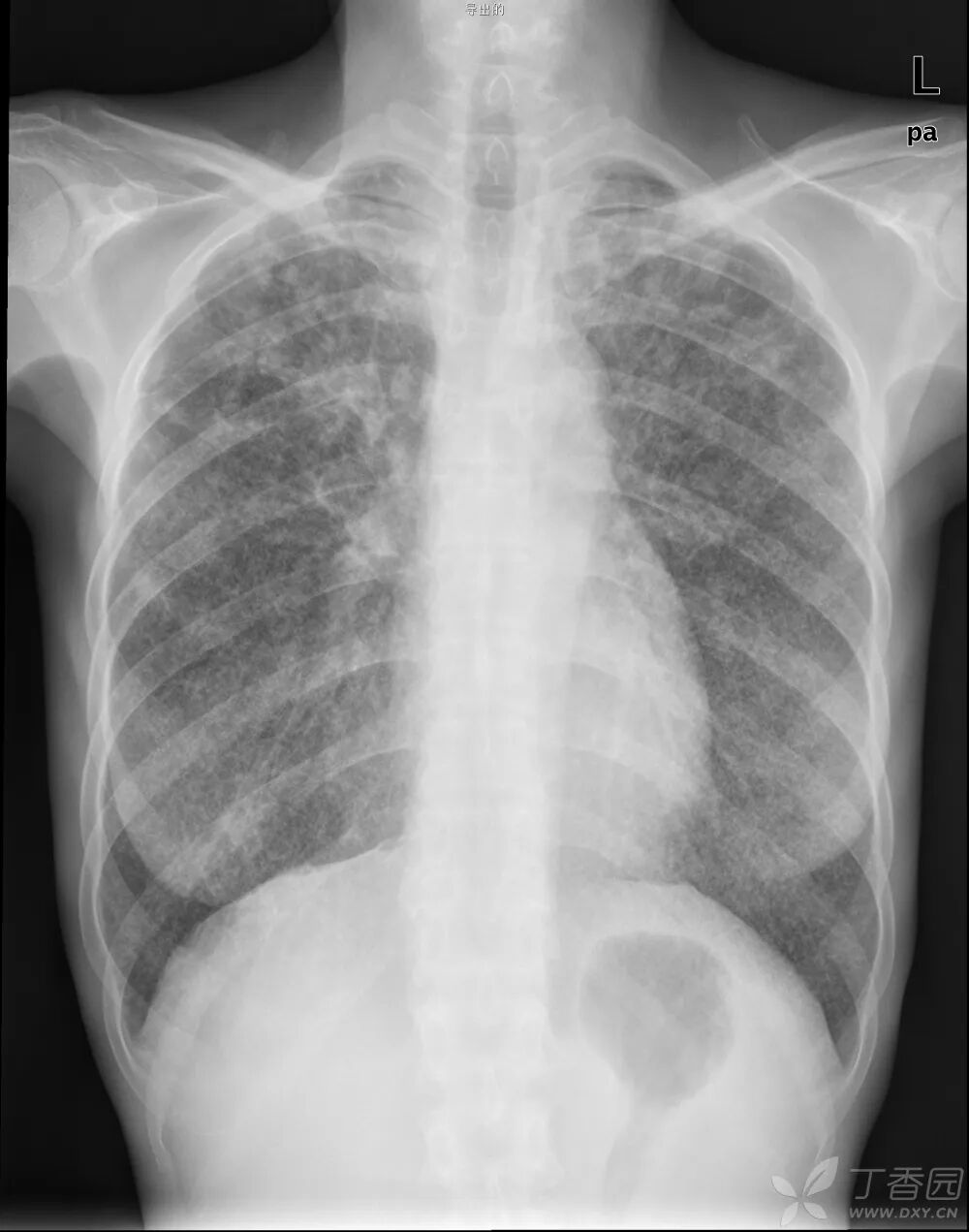 X光拍片为什么要等都是拍片，DR、CT、MRI，到底啥区别？_https://www.jmylbn.com_新闻资讯_第4张