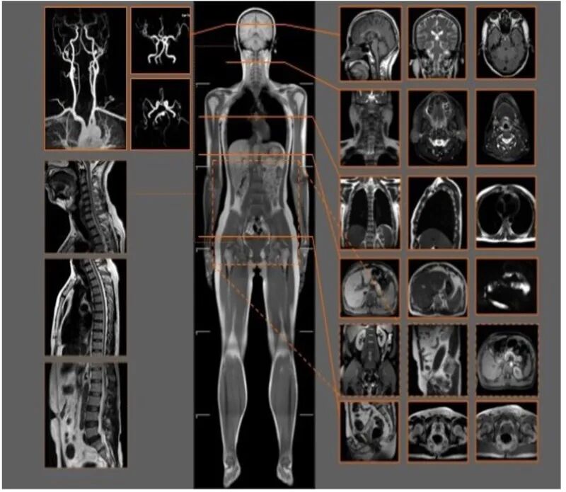 X光拍片为什么要等都是拍片，DR、CT、MRI，到底啥区别？_https://www.jmylbn.com_新闻资讯_第12张