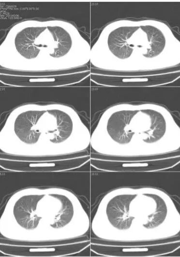 X光拍片为什么要等都是拍片，DR、CT、MRI，到底啥区别？_https://www.jmylbn.com_新闻资讯_第9张