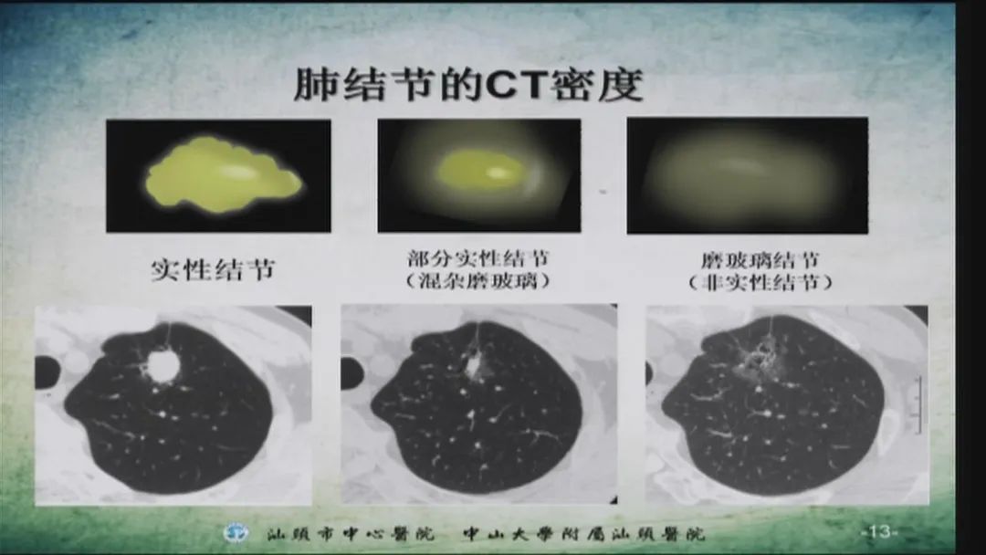 健康新生活肺部篩查有利器