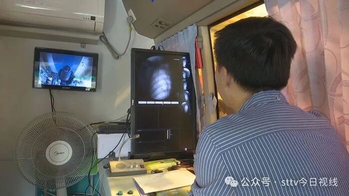 世界防治结核病日x光车开进了乡村