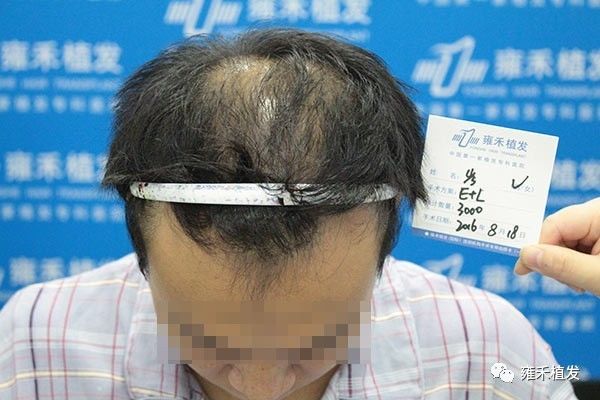 给90后脱发人的几个劝告……90%的人看了说是实用！