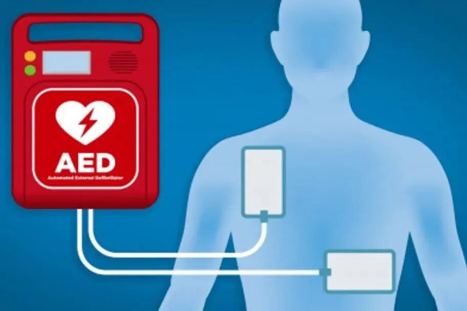 aed电极贴怎么贴人人都学习丨AED如何使用？_https://www.jmylbn.com_新闻资讯_第1张