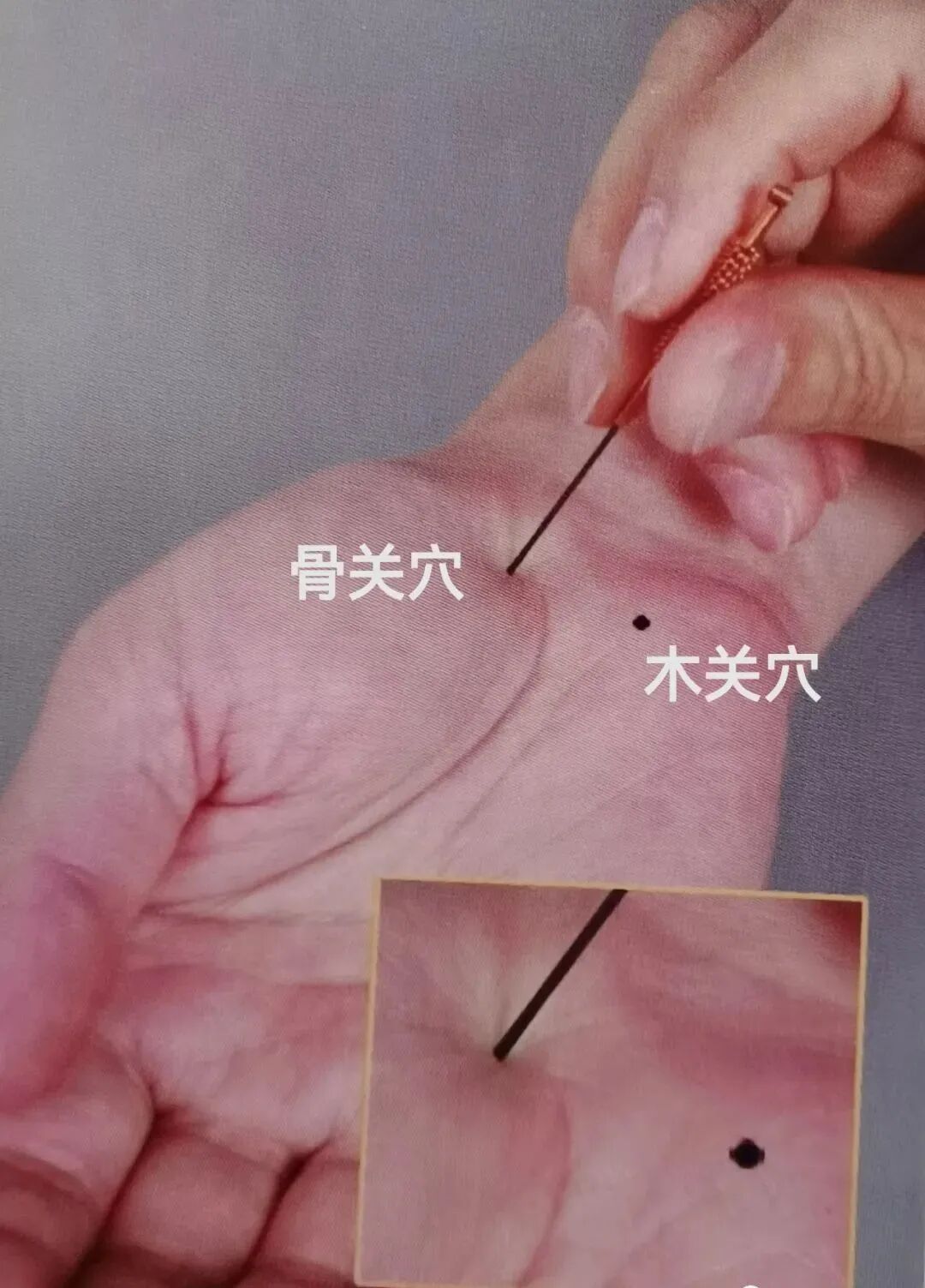 【部位】手掌朝上,腕横纹正中央下五分偏大拇指侧五分,豌豆骨下是穴.