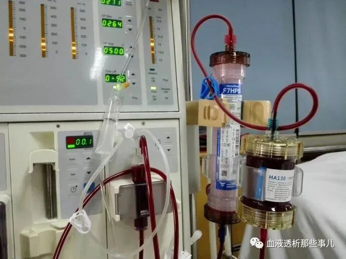 透析器材包括哪些血透核心：透析器_https://www.jmylbn.com_新闻资讯_第4张
