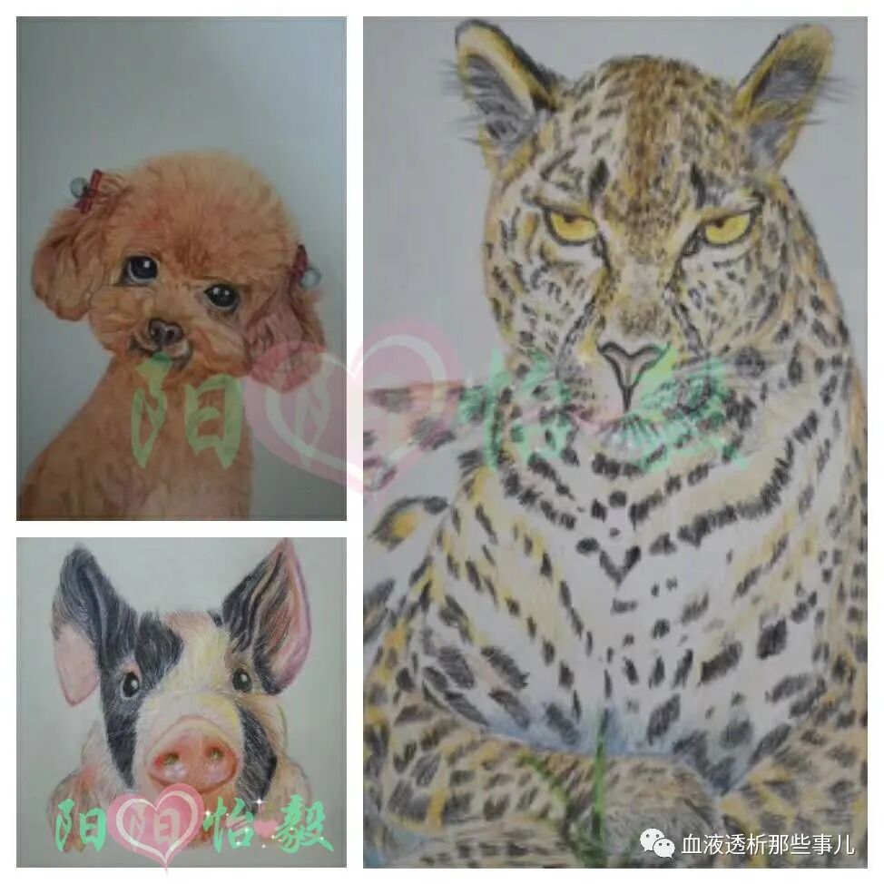 透析器材包括哪些血透核心：透析器_https://www.jmylbn.com_新闻资讯_第5张