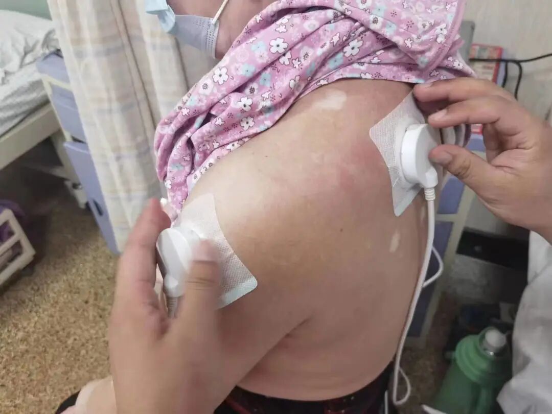 透药有什么作用超声电导透药治疗 ｜ 让中医治疗如虎添翼_https://www.jmylbn.com_新闻资讯_第5张