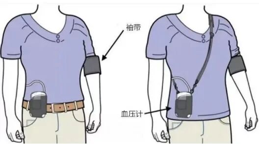 动态血压怎么佩带【健康百宝箱】远程动态血压监测——掌握自己的真实血压_https://www.jmylbn.com_新闻资讯_第5张