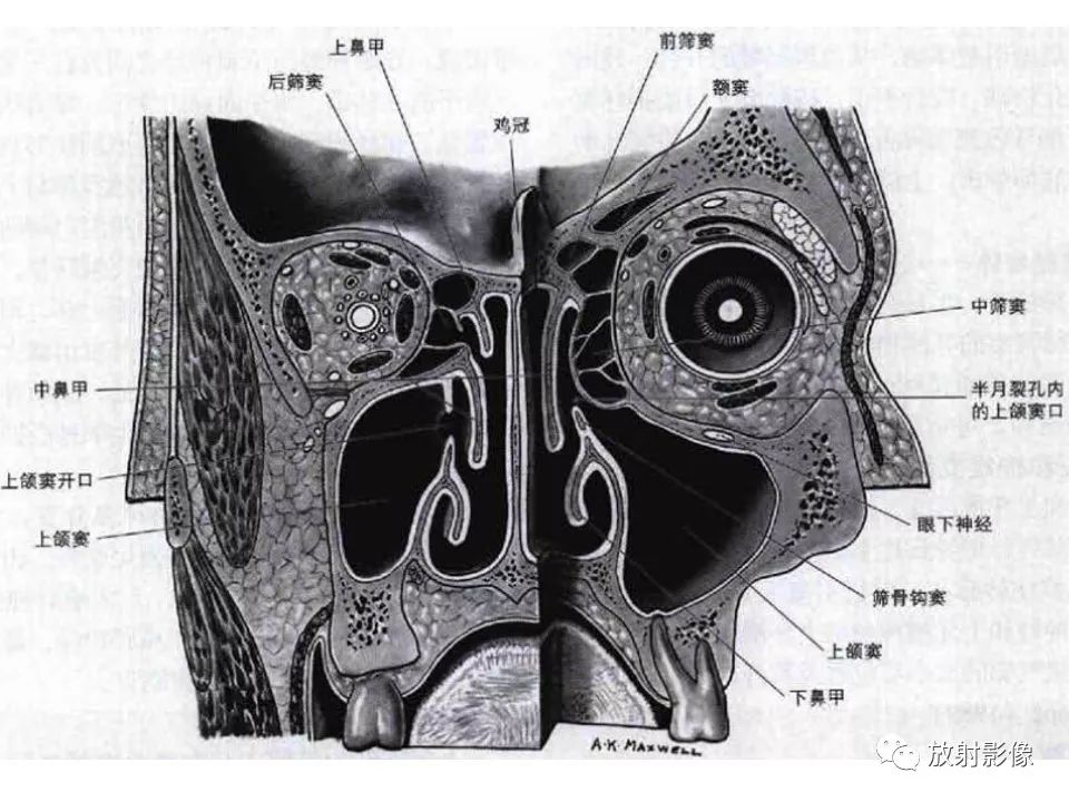 鼻道窦口复合体解剖图片