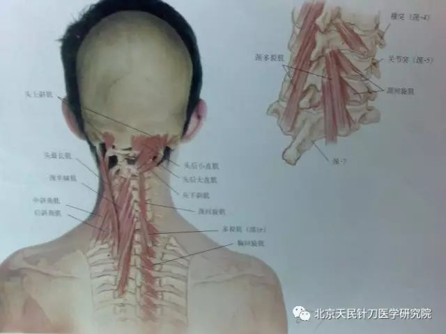 横突的触摸定位法 天民针刀 微信公众号文章阅读 Wemp