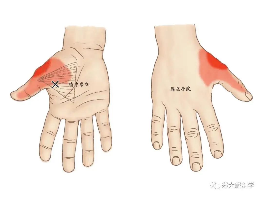 身体肌肉扳机点位置、成因与症状分析（深度好文）