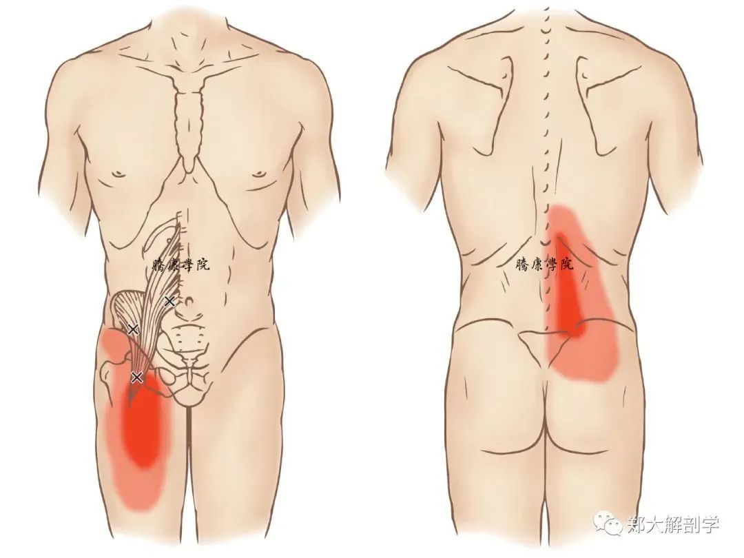 身体肌肉扳机点位置、成因与症状分析（深度好文）