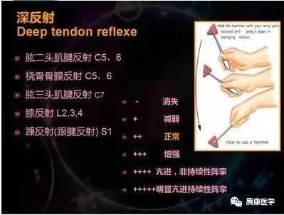 肱三头肌反射:由c6-7支配,经桡神经传导.3.桡骨膜反射:由c5-6支配.