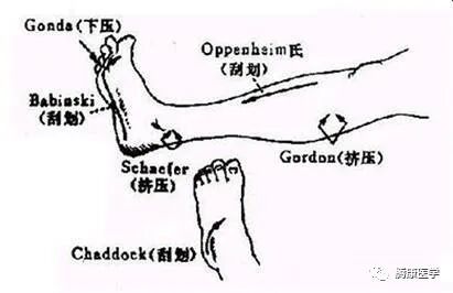 3.强握反射:指检查者用手指触摸患者手掌时被强直性握住的一种反射.