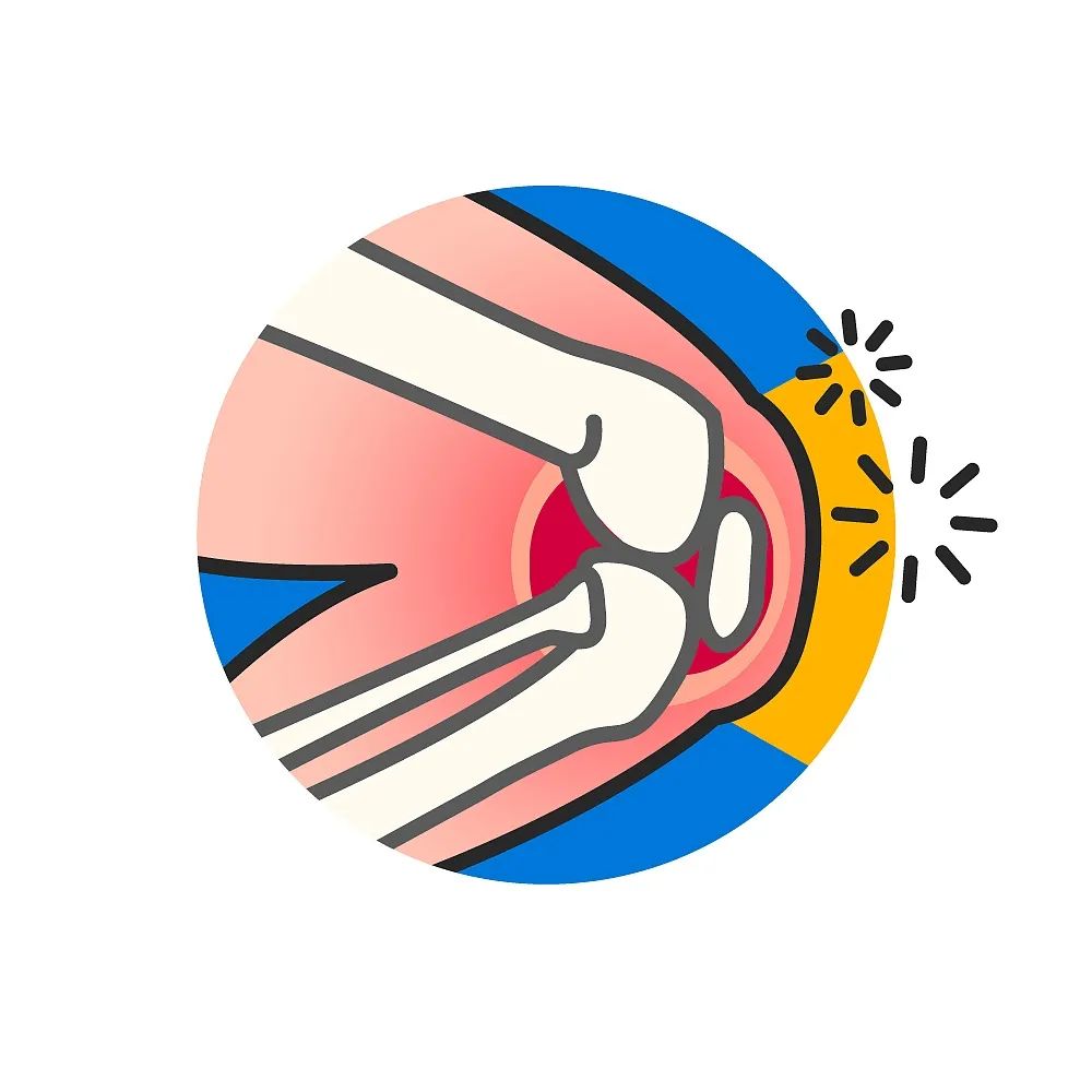 【健康】膝盖这件事,骨科医生和你聊一聊