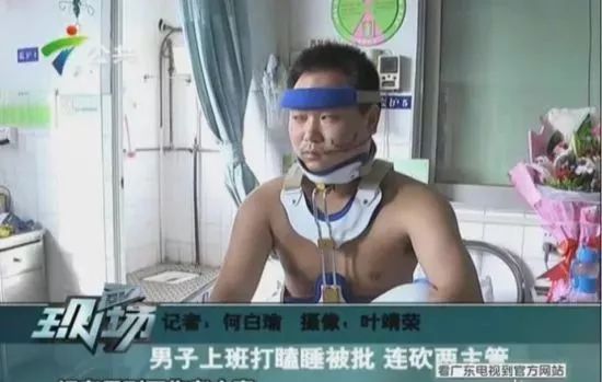 一名伤者脸部被砍了两刀。(视频截图)