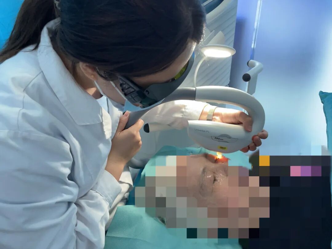 光热治疗仪有什么作用眼睛干涩怎么办？福建协和眼科再添干眼治疗利器——最新一代科医人M22强脉冲光治疗仪_https://www.jmylbn.com_新闻资讯_第6张