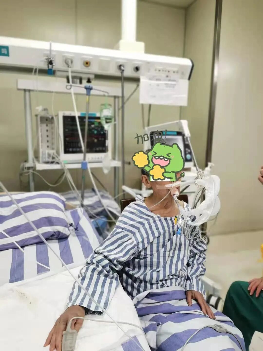 什么是有创呼吸机图片揭秘ICU“救命神器”之——呼吸机_https://www.jmylbn.com_新闻资讯_第38张