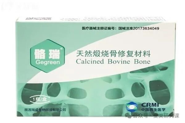 异体骨有哪些品牌揭露种牙骨粉十大品牌榜：对比国产／进口骨粉作用和功效还有价格分享_https://www.jmylbn.com_新闻资讯_第5张