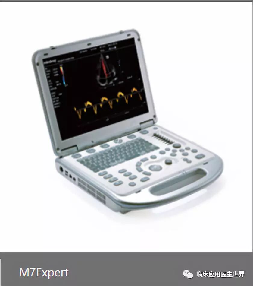开立超声怎么导出图像273期：超声临床应用医生的银色记忆——盘点超声兵器谱_https://www.jmylbn.com_新闻资讯_第3张
